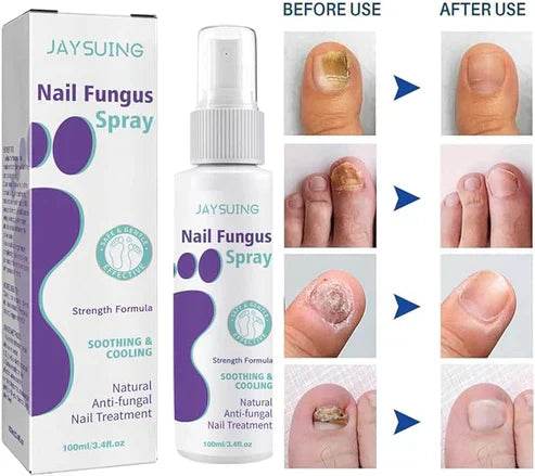 nail fungus spray